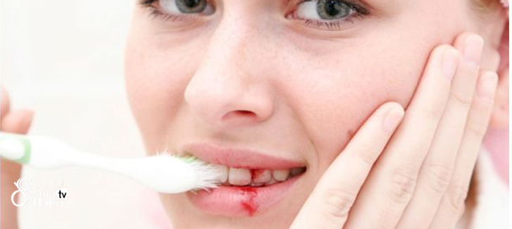 Dişleri fırçalarken diş eti kanaması normal bir durum değildir ve diş eti iltihabının en önemli belirtisidir. Vakit kaybetmeden diş hekimine başvurulması gerekmektedir.